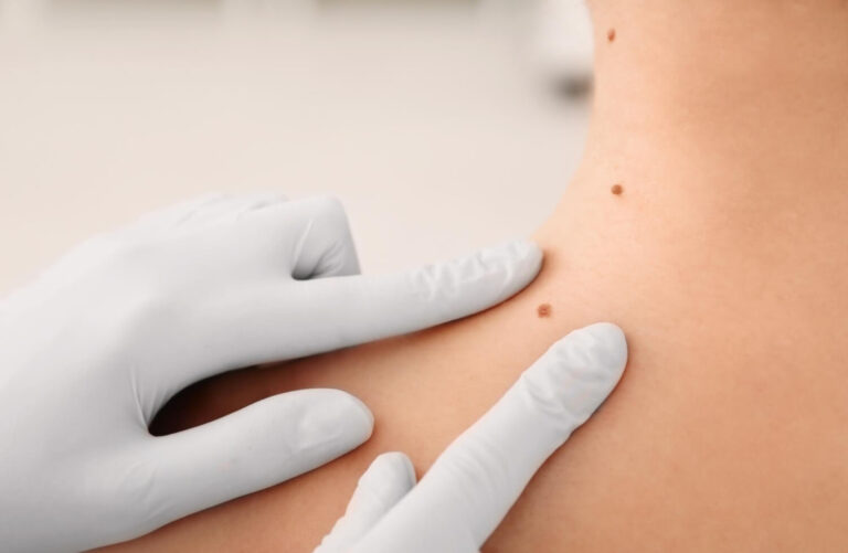 מאמר בבלוג של לנטה